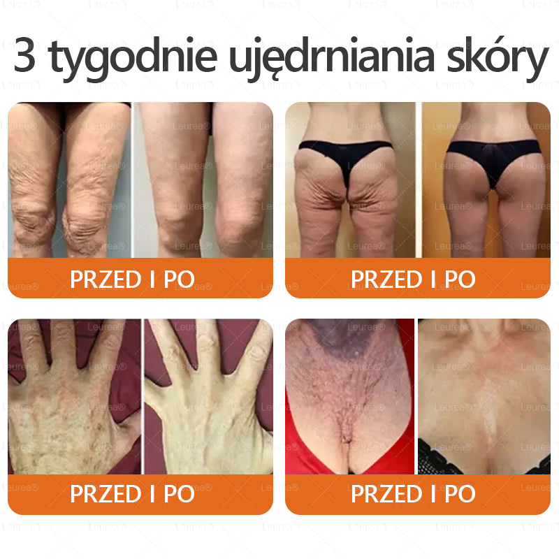 Leurea® Krem z Jadem Pszczelim 🔥 Regeneracja skóry, redukcja zmarszczek i promienny wygląd – 50 ml