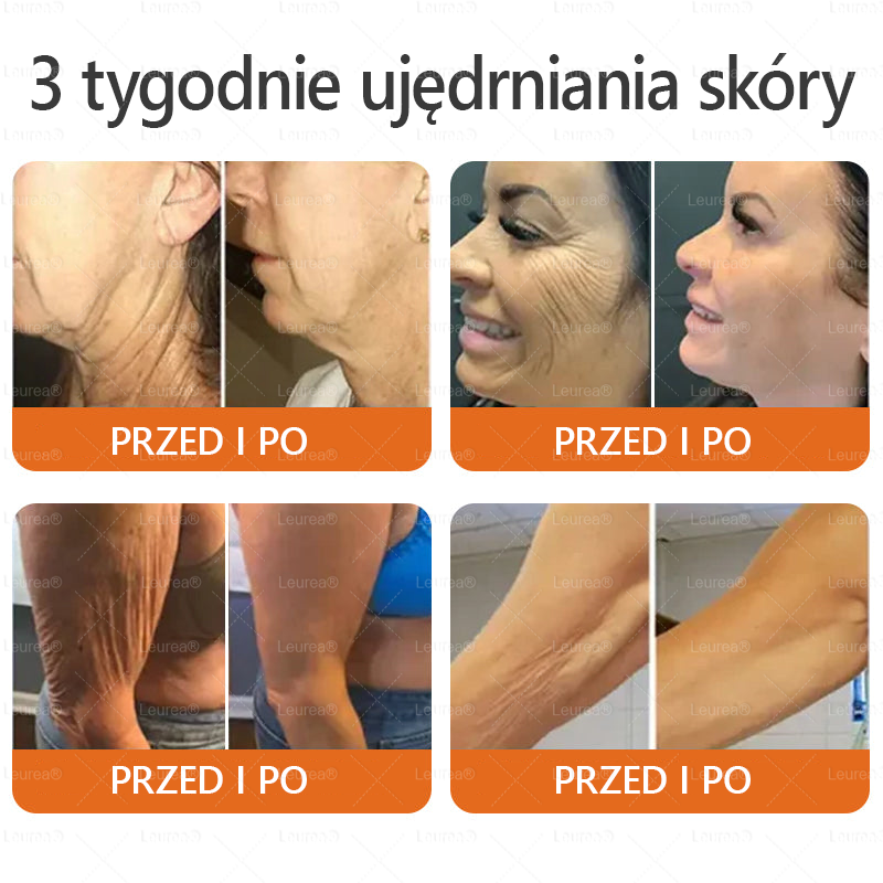 Leurea® Krem z Jadem Pszczelim 🔥 Regeneracja skóry, redukcja zmarszczek i promienny wygląd – 50 ml