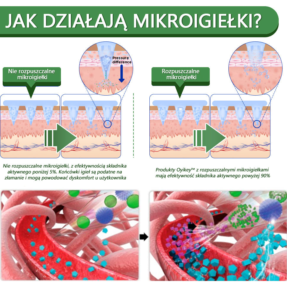 Voilaist® SMGT-GLP-1 Nano Microneedle Patch(Bezbolesny, długotrwały, zwalczający cukrzycę, otyłość i choroby układu krążenia)