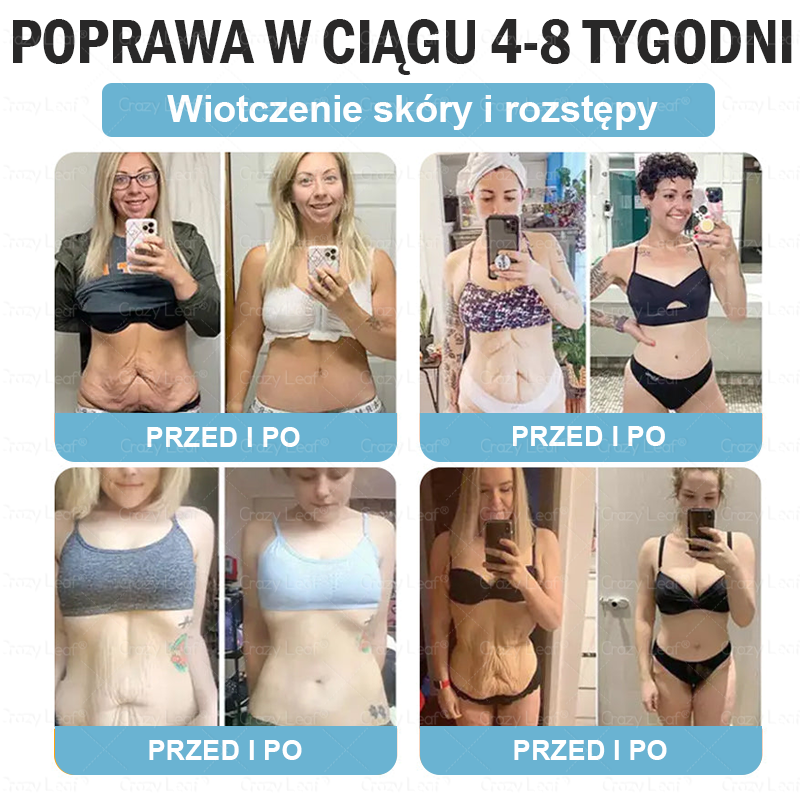 CrazyLeaf® Szczupłość i Witalność Tirzepatide – doustny roztwór wspierający odchudzanie, ciśnienie i poziom cukru