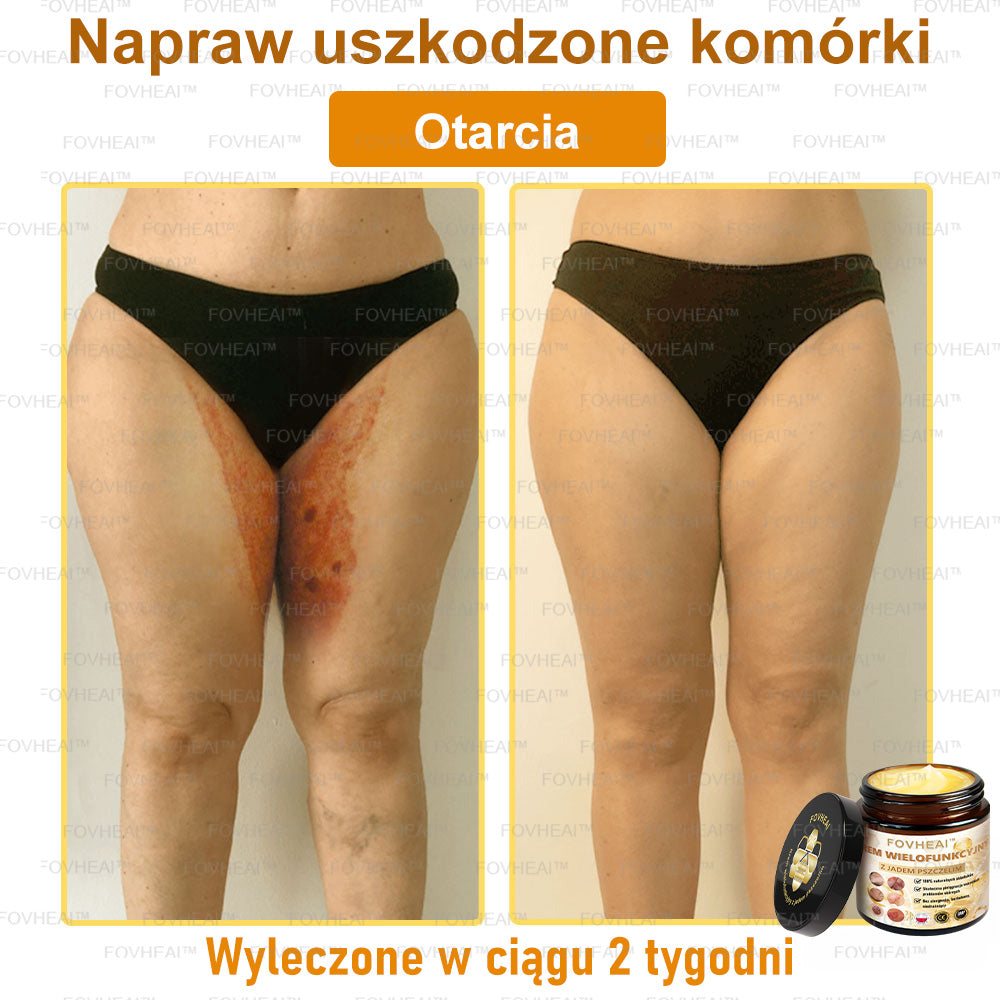🔥 Leurea® Krem z Jadem Pszczelim – Wygładza zmarszczki i przywraca młody wygląd – 50 ml