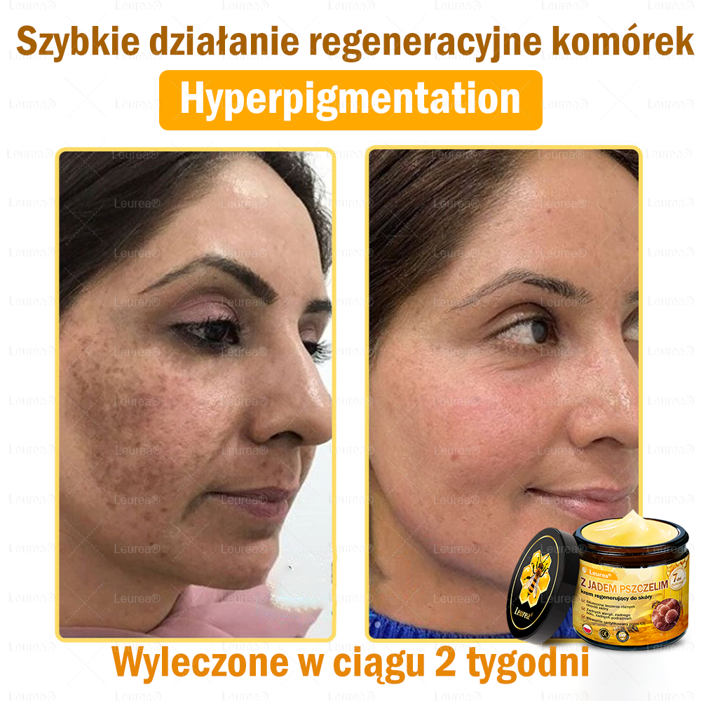 Leurea® Krem z Jadem Pszczelim 🔥 Regeneracja skóry, redukcja zmarszczek i promienny wygląd – 50 ml