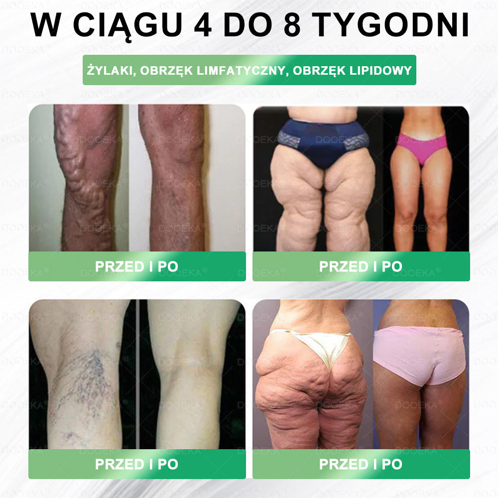 🎁 Zostało tylko 5 opakowań! Oferujemy Ci dodatkowe 50% zniżki – zadbaj o swoją sylwetkę i zdrowie już teraz! Jeśli przegapisz tę okazję, w przyszłym roku może być już za późno...