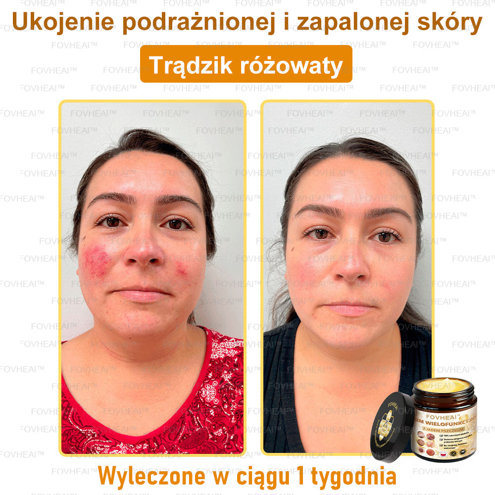 🔥 Leurea® Krem z Jadem Pszczelim – Wygładza zmarszczki i przywraca młody wygląd – 50 ml