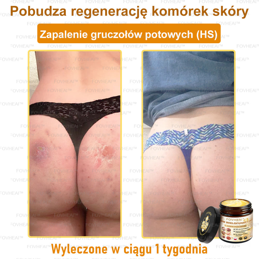 🔥 Leurea® Krem z Jadem Pszczelim – Wygładza zmarszczki i przywraca młody wygląd – 50 ml
